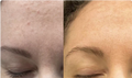 Frøya Natural Skincare System for Mature Women